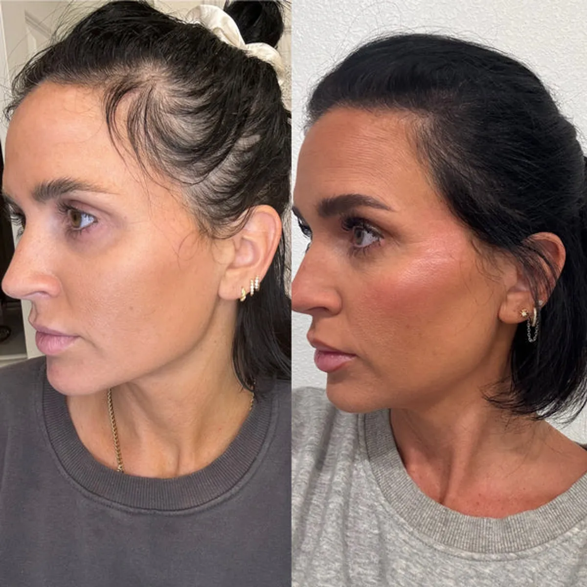 Hair Growth Serum – where to buy: a detail view of the product