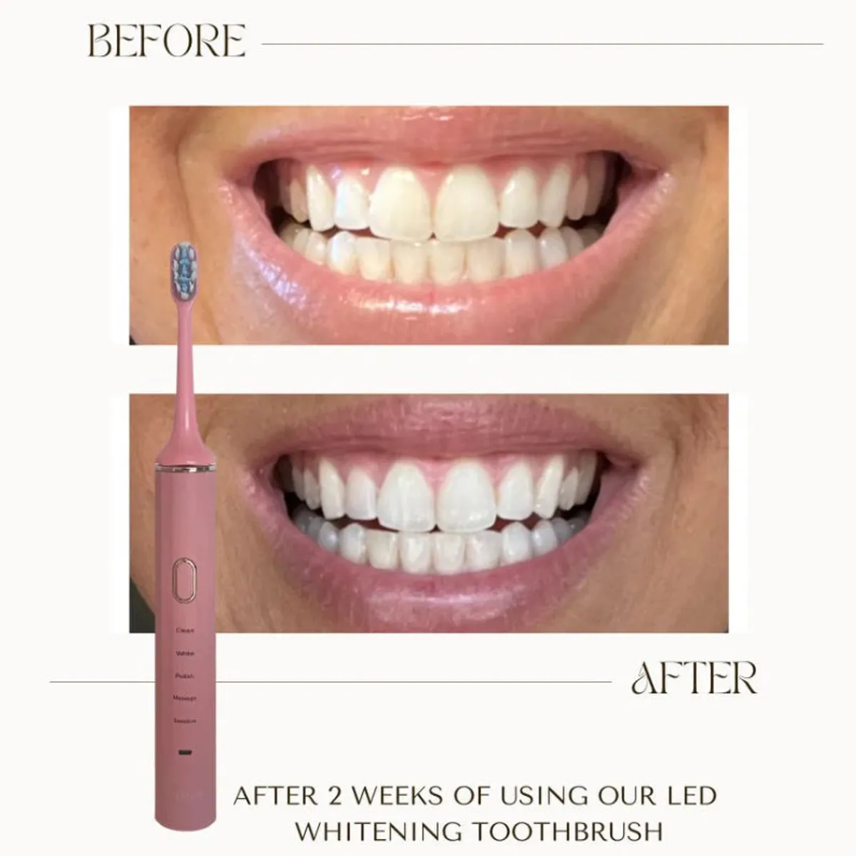 Pink LED Toothbrush – price: a closer look at the product