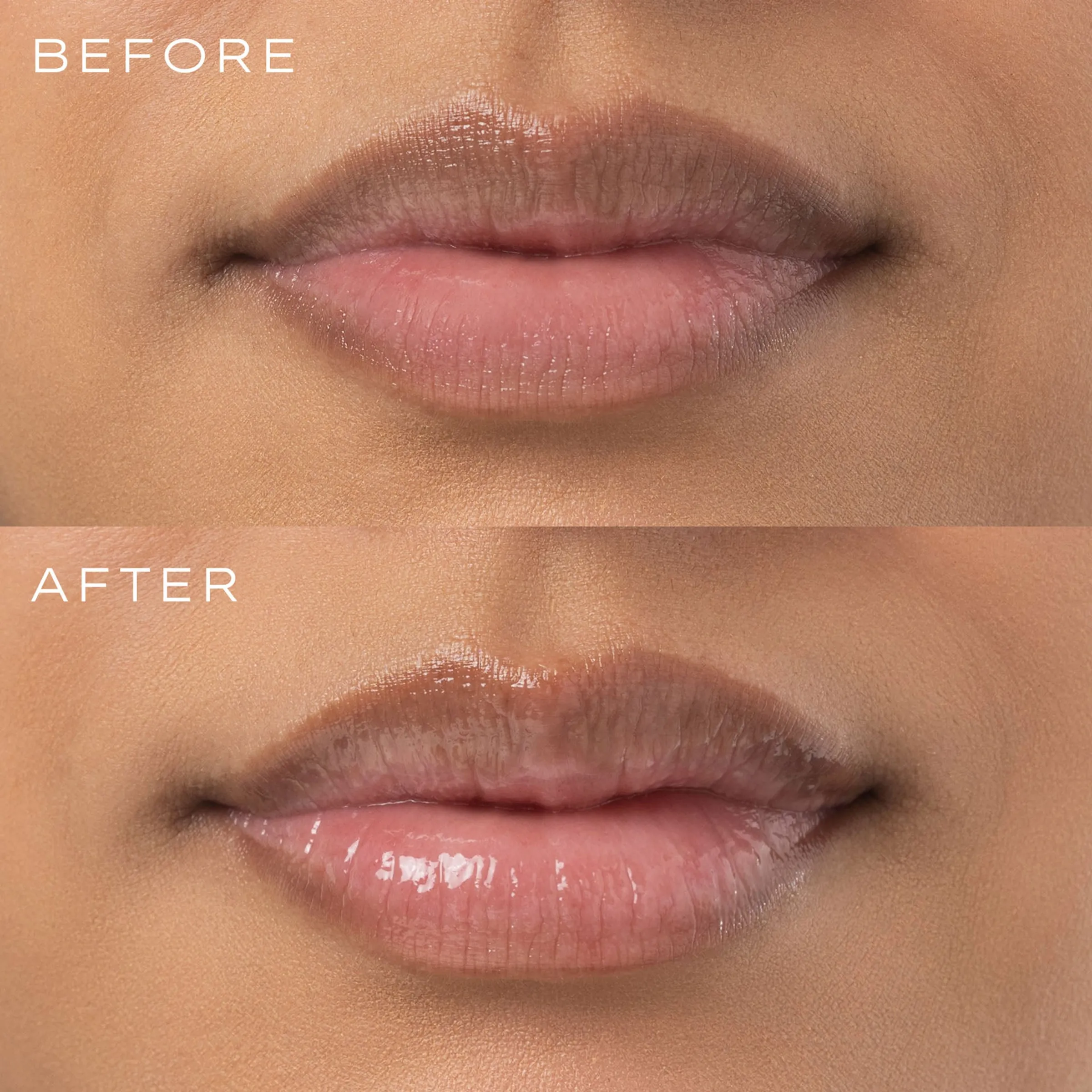 A minha opinião: Volumizador de lábios YOUNIQUE Perfect Pout - Antes e depois