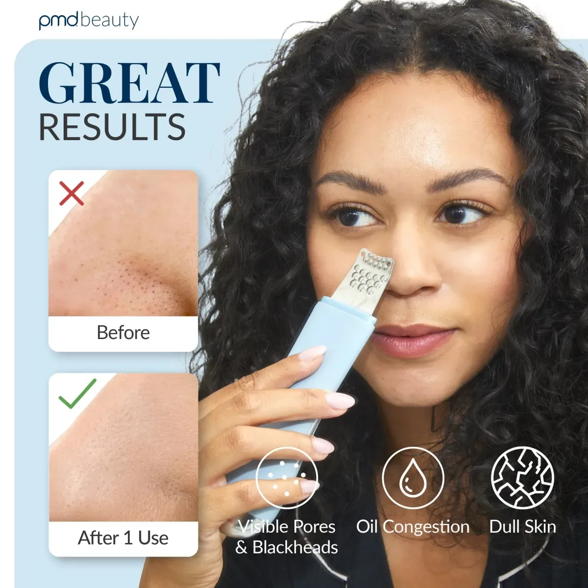 PMD Wave Pro – prix : résultats avant et après une utilisation sur le nez, avec l’appareil appliqué sur une femme aux cheveux bouclés